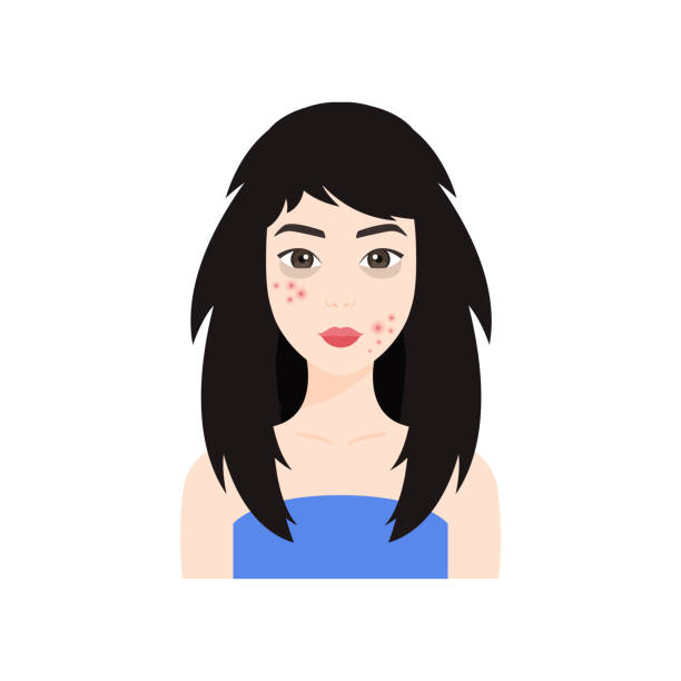 красивая азиатская женщина с проблемной кожей на лице. прыщи и темные круги под глазам�и. японская леди с плохо поврежденными волосами. неоп� - wrapped in a towel illustrations stock illustrations