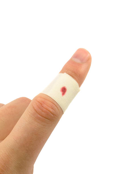 istock on the damaged finger sticking plaster 1432478162