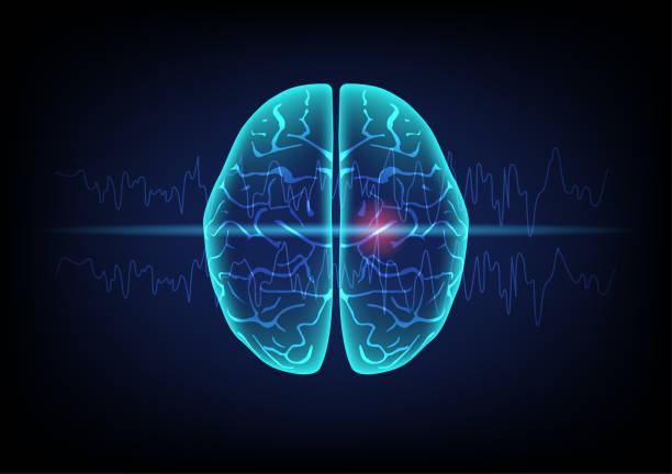 Concept of focal seizure and human brain. Illustration of human brain and brain wave on technology background. Concept of focal seizure. epilepsy stock illustrations