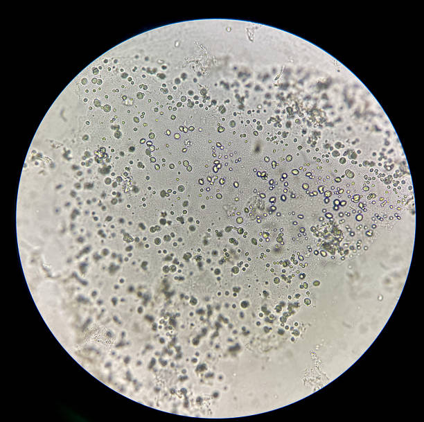 丸い厚い壁の酵母細胞。 - 酵母 ストックフォトと画像