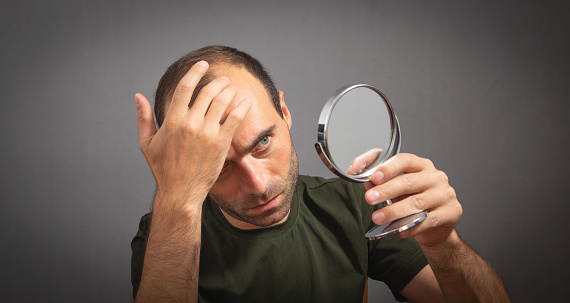 Man looking at mirror. Hair loss concept