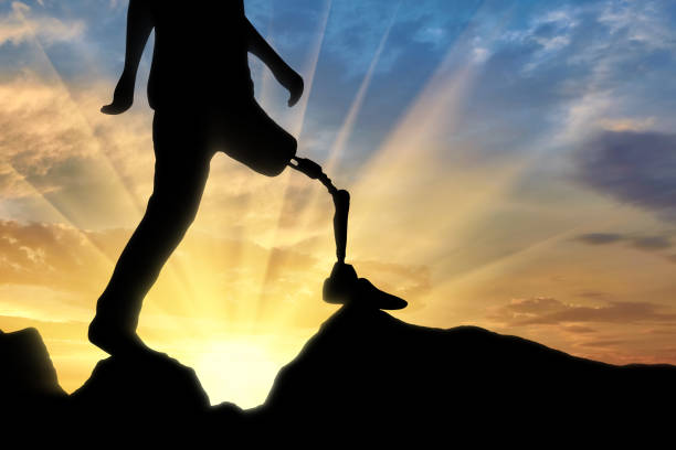 istock Concept of disability, prosthetic leg 1432606583