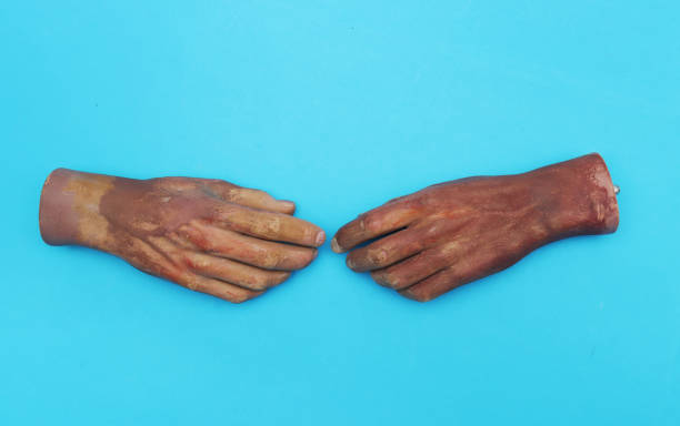 istock Two wrists from a human hand from a large doll on blue background. 1432680754