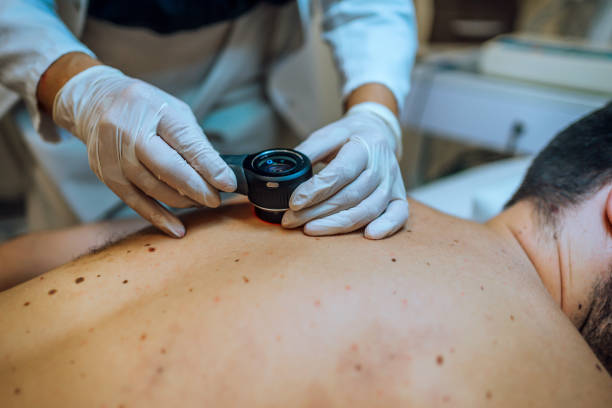 istock Dermatologist inspecting patient skin moles 1432941733