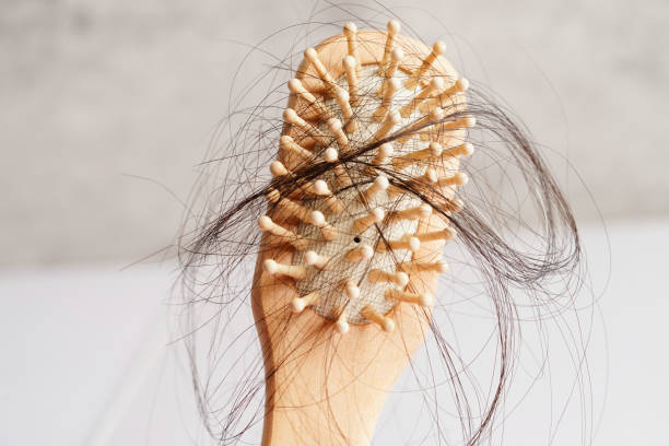 istock Hair loss fall with comb brush isolated on white background. 1433139107