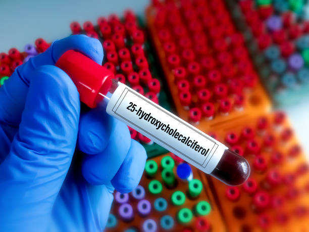 istock Blood sample for 25-hydroxycholecalciferol test, also known as 5-hydroxyvitamin D₃, calcifediol or calcidiol, is a form of vitamin D produced in the liver by hydroxylation of vitamin D₃ 1433174670