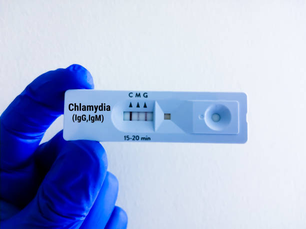 istock Chlamydia Rapid Antibody test. Rapid screening test for Chlamydia. 1433174674