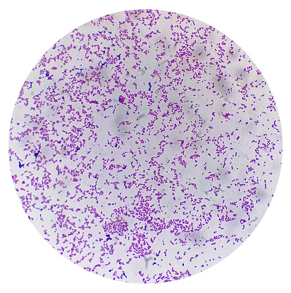 Gram staining, also known as Gram's method, is a method of differentiating bacterial species into two large groups (Gram positive and Gram negative).