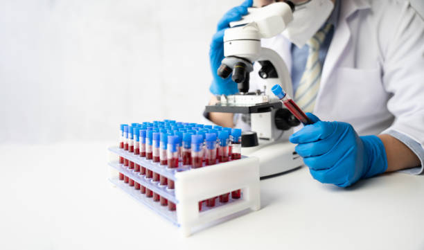 doutor à mão pegando um tubo de amostra de sangue de um rack com máquinas de análise no fundo do laboratório, técnico segurando teste de tubo de sangue no laboratório de pesquisa. - blood sample blood tube pathologist - fotografias e filmes do acervo