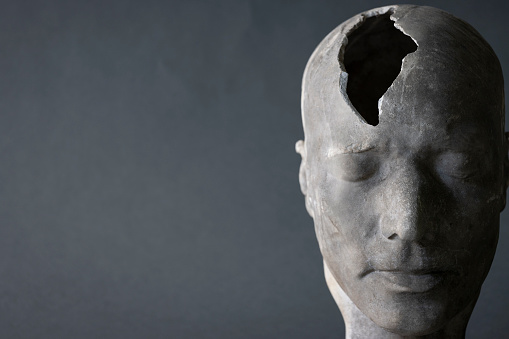 Mental Health Concept Showing Model Of Head With Fractured Piece In Skull