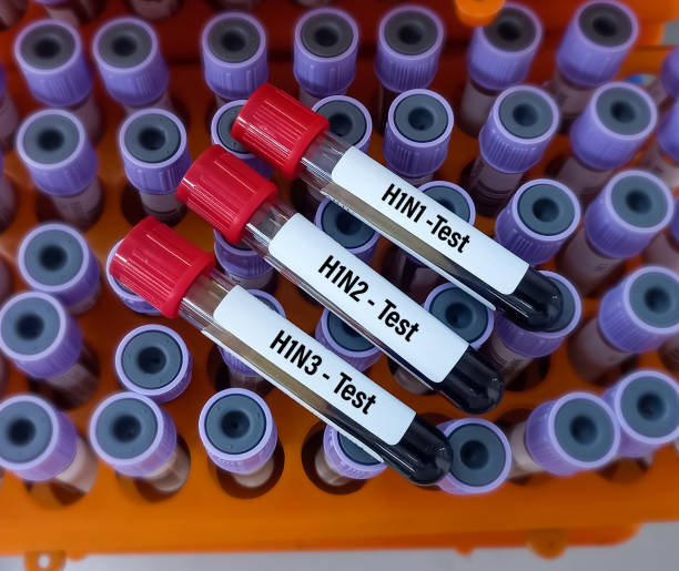 Blood Samples for Influenza A virus subtype H1N1, H1N2 and H1N3 test. Blood Samples for Influenza A virus subtype H1N1, H1N2 and H1N3 test. h1n1 flu virus stock pictures, royalty-free photos & images