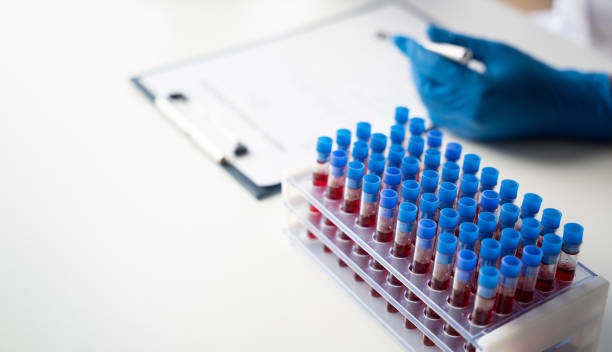 doutor à mão pegando um tubo de amostra de sangue de um rack com máquinas de análise no fundo do laboratório, técnico segurando teste de tubo de sangue no laboratório de pesquisa. - blood sample blood tube pathologist - fotografias e filmes do acervo