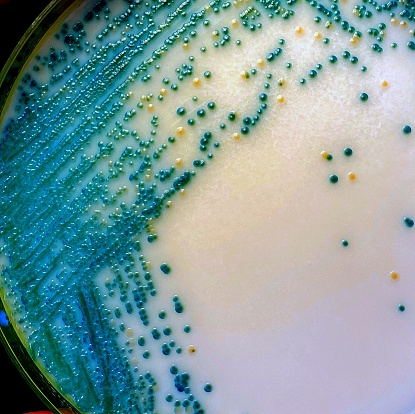Mixed culture of Candida albicans (turquoise) and Candida glabrata (yellow) colonies grown on a diagnostic chomogenic agar plate. Life-threatening invasive fungal infections are becoming increasingly common in immunocompromised patients.