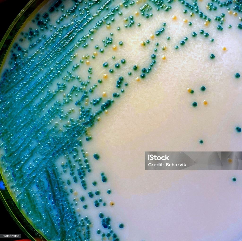 Opportunistic yeast pathogens Mixed culture of Candida albicans (turquoise) and Candida glabrata (yellow) colonies grown on a diagnostic chomogenic agar plate. Life-threatening invasive fungal infections are becoming increasingly common in immunocompromised patients. Micro Organism Stock Photo