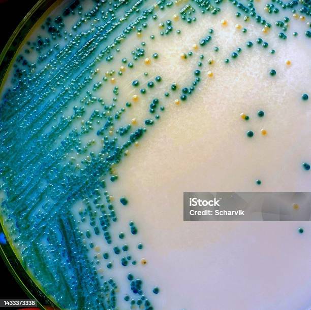 Opportunistic Yeast Pathogens Stock Photo - Download Image Now - Micro Organism, Petri Dish, Backgrounds