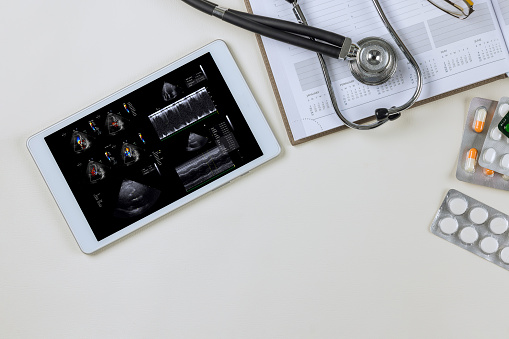 There is a doctor on digital tablet who checks the results of echocardiography ultrasound in order to prescribe an effective treatment plan for patient