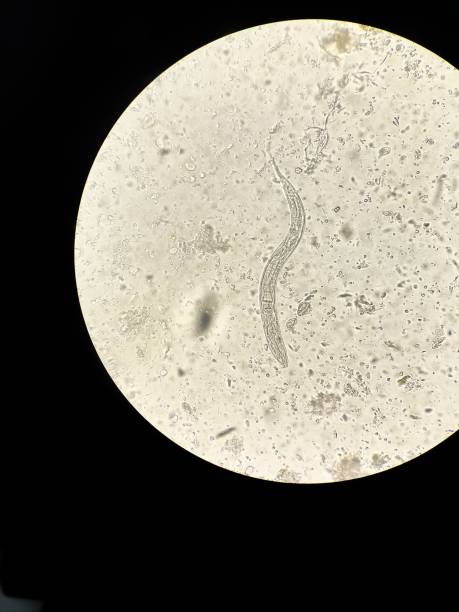 istock Vertical shot of a parasite 1433572375