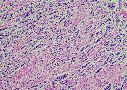 Cryptosporidiosis, a diarrheal disease caused by Cryptosporidium parvum protozoan. 3D illustration showing release of parasite sporozoites from oocyst inside small intestine