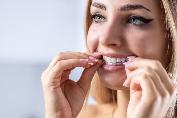 istock A woman puts on an invisible silicone teeth aligner. Dental braces for teeth correction. 1433819207