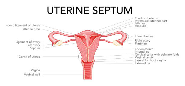 istock Uterine septum septate uterus Female reproductive system diagram with inscriptions text. Front view in a cut. Human anatomy internal organs flat style icon Vector medical illustration isolated 1433926524