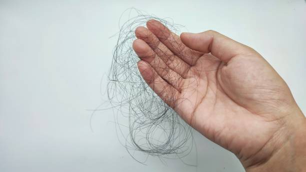 Hair lost the hand holding the loose strands of hair hair strands stock pictures, royalty-free photos & images