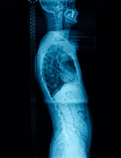 Human spine on green background