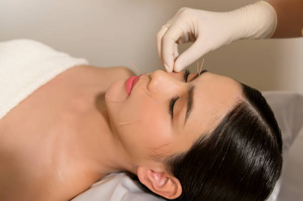 아름다운 여자 치료사, 한약 치료, 건강 및 치유 개념에 의해 얼굴에 침술 치료를 받았습니다. - massaging thailand thai culture shiatsu 뉴스 사진 이미지