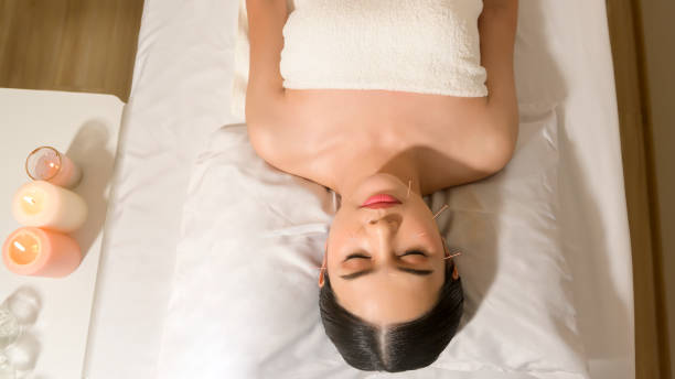 bella donna ha ricevuto un trattamento di agopuntura sul viso dal terapeuta, trattamento di medicina cinese, concetto di salute e guarigione. - alternative therapy massaging clinic health spa foto e immagini stock