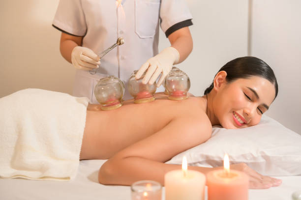 bella donna ha ricevuto un trattamento di coppettazione sulla schiena dal terapeuta, trattamento di medicina cinese, concetto di salute e guarigione. - alternative therapy massaging clinic health spa foto e immagini stock