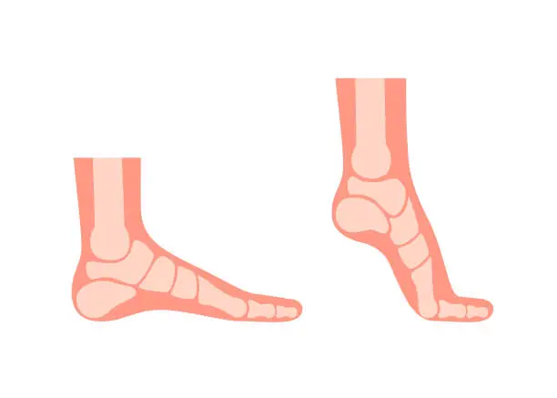 Vector illustration of Silhouette human foot with bones, orthopedic leg, healthy feet. Full foot and tiptoe. Foot normal, flat foot. Supination and pronation. Vector illustration