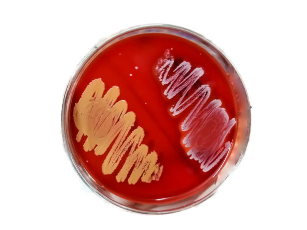 シャーレ上の血液寒天中の細菌コロニー。細菌培養培地。微生物学者。細菌。 - agar jelly medical sample bacterium microbiology ストックフォトと画像