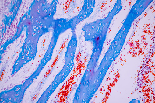 Hyaline cartilage, Elastic cartilage and Bone Human under the microscope in Lab.