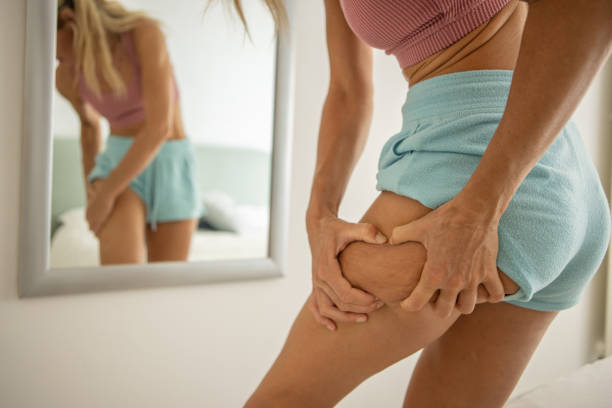 Pinching thigh cellulite in the mirror Woman taking care of her body cellulite stock pictures, royalty-free photos & images