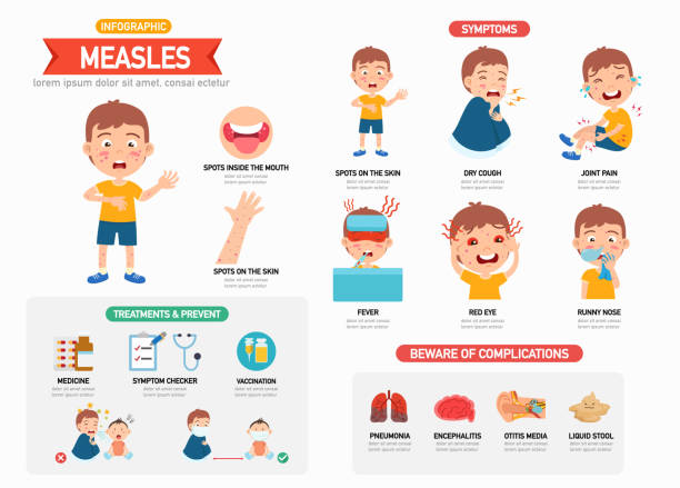 illustrazioni stock, clip art, cartoni animati e icone di tendenza di infografica sul morbillo con i personaggi dei bambini che rappresentano l'illustrazione vettoriale dei sintomi - chickenpox skin condition baby illness