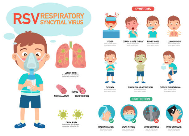 rsv respiratory syncytial virus infographic vector illustration. - 咳嗽 插圖 幅插畫檔、美工圖案、卡通及圖標