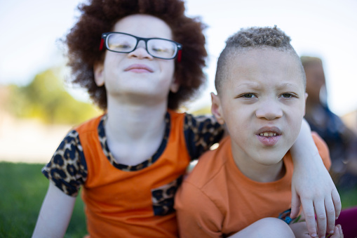 African American twin siblings boy and girl with albinism having fun at the park.