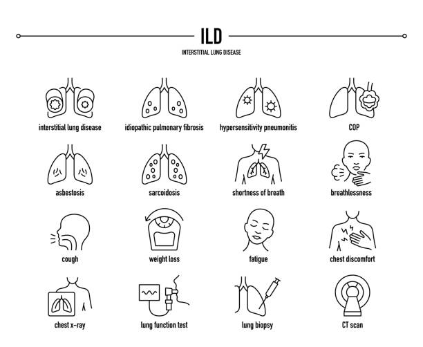 ilustrações de stock, clip art, desenhos animados e ícones de ild, interstitial lung disease vector icon set - bronquiolite