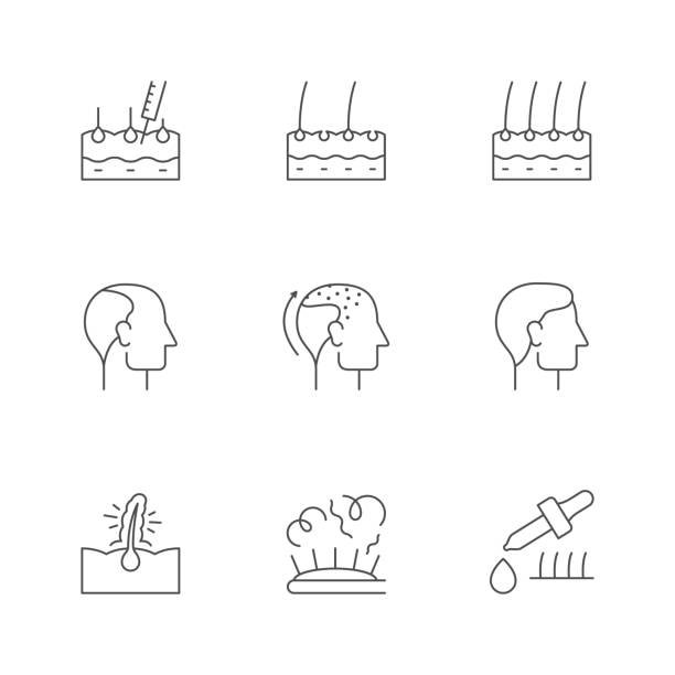 ilustrações, clipart, desenhos animados e ícones de definir ícones de linha de queda de cabelo - alopecia homem