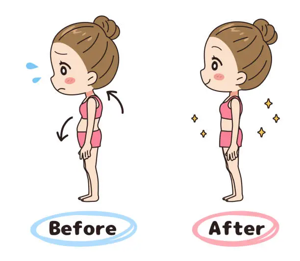 Vector illustration of Before-after illustration set of a woman whose posture has been corrected.