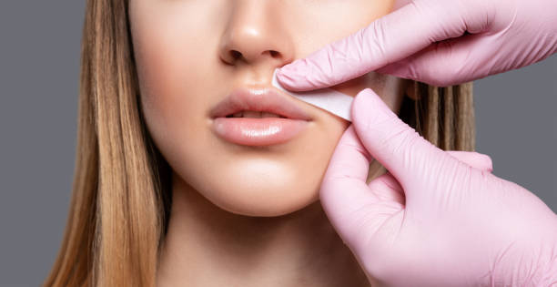 미용사는 젊은 여성에게 왁스로 콧수염을 제거합니다. 여성의 몸에 제모 절차. - 얼굴부위 털 뉴스 사진 이미지