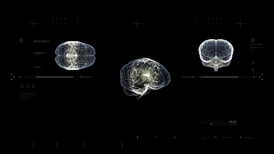 Futuristic biomedical concept of a holographic scanning a patient's brain neuron pathology and diagnostic scan