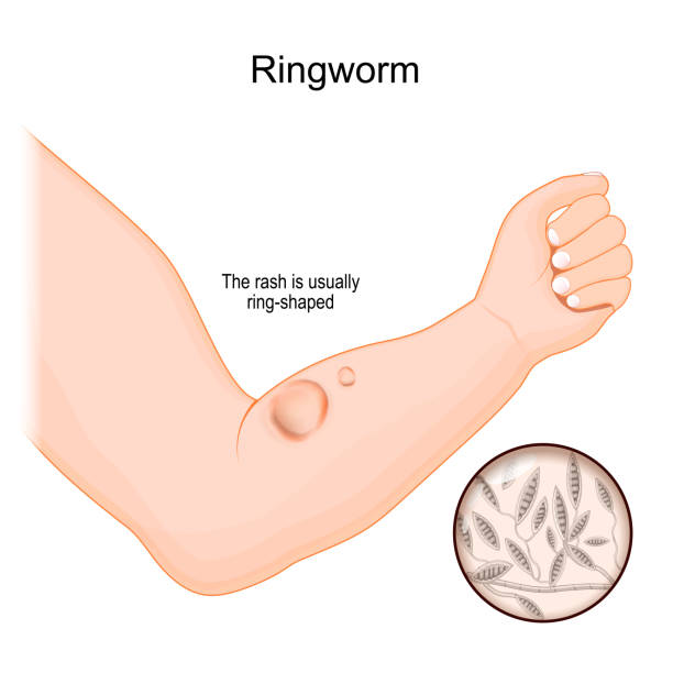 30+ Ringworm Microscope Stock Photos, Pictures & Royalty-Free Images -  iStock
