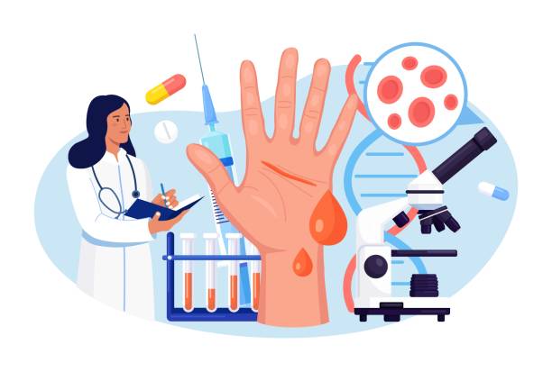 hemofilia. dokter memeriksa non-koagulasi darah. tangan dengan pendarahan, luka yang tidak dipanaskan. dokter merawat pasien dengan anemia, penyakit darah. tes terperinci untuk sel darah merah, trombosit - hematologi ilustrasi stok