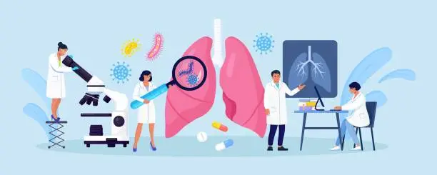 Vector illustration of Pulmonology concept. Group of Doctors Check Up Lungs Affected by Coronavirus. Doctor Exam Respiratory System, Treat Lung Disease. Fibrosis, Tuberculosis, Pneumonia, Cancer