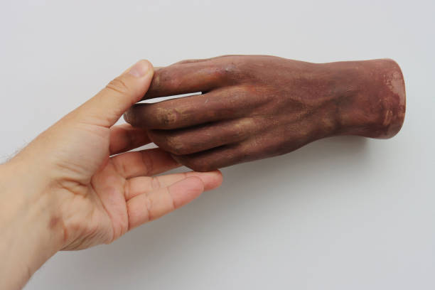istock A man's hand touches an artificial hand from a mannequin. 1435694223