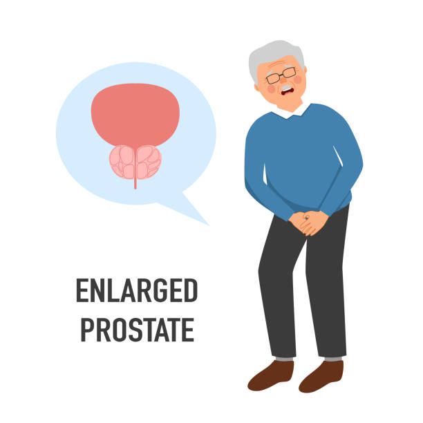 Prostate Problems Graphics 30+ Prostate Cancer Anatomy Illustrations, Royalty-Free Vector Graphics ...
