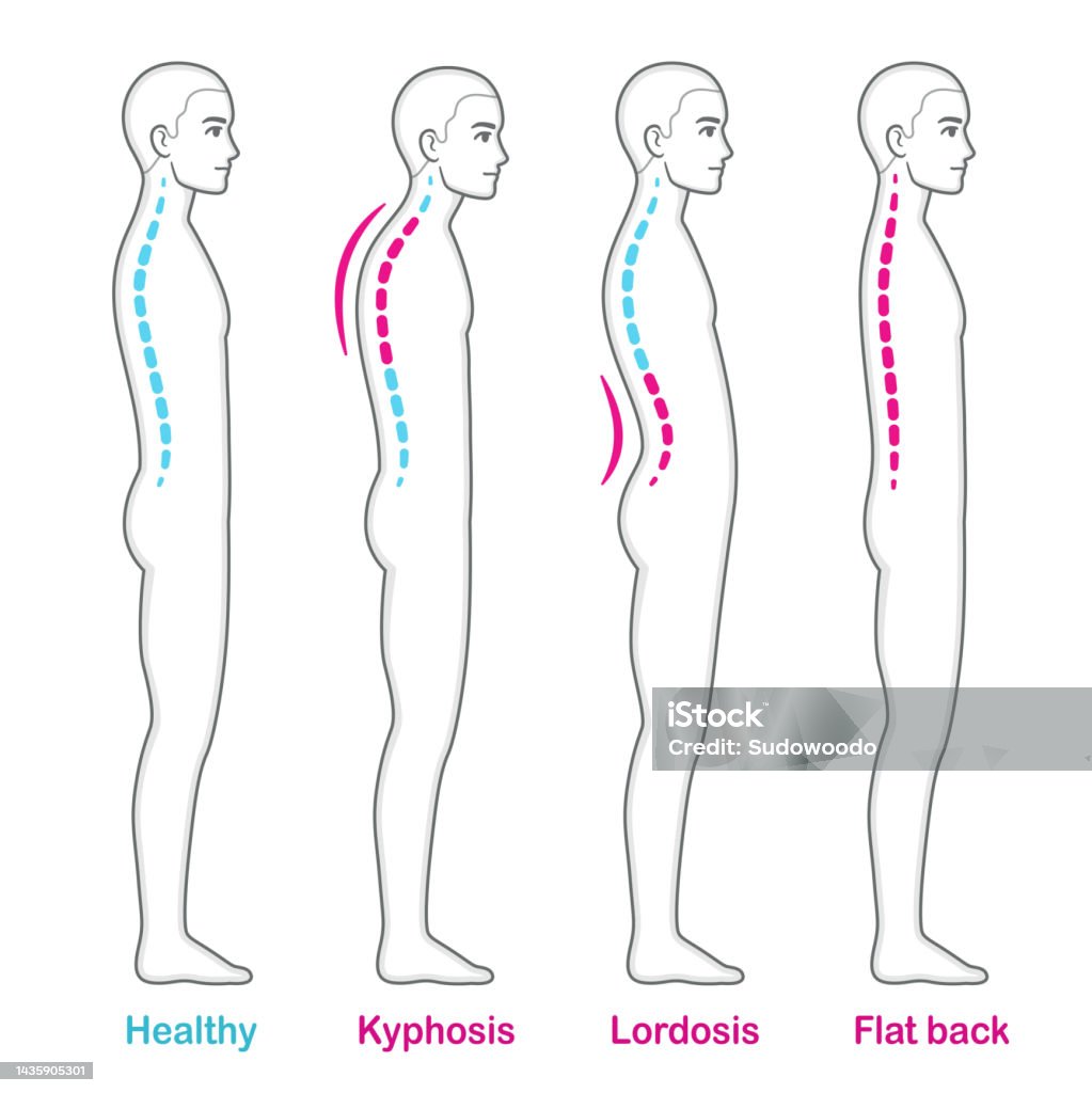 Posture And Back Problems Spine Infographic lower-back-pain-causes-treatment-prevention