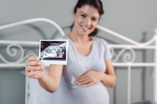 Beautiful pregnant woman holding her baby sonography and looking at the camera