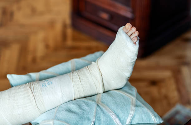 istock Female leg in plaster on a pillow 1436105173