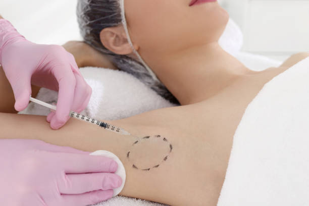 istock Cosmetologist injecting young woman's armpit, closeup. Treatment of hyperhidrosis 1436120626